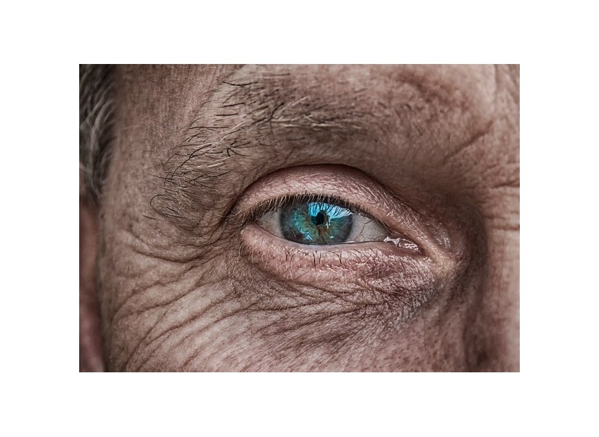 Les causes et les traitements de la sécheresse oculaire 